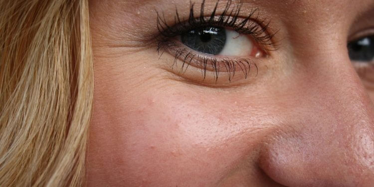 zmarszczki pod oczami